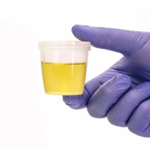 Drug Testing