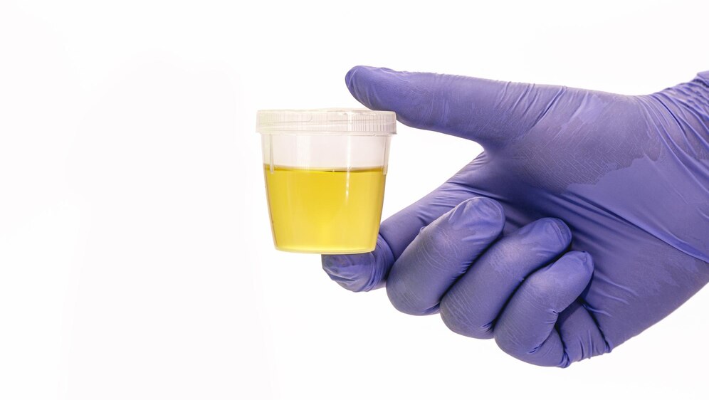 Drug Testing